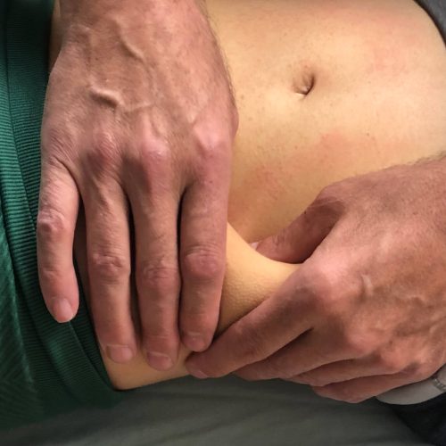 ABDOMINAL VISCERAL MOBILIZATION III